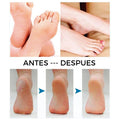 Exfoliante De Pies y Removedor de Durezas